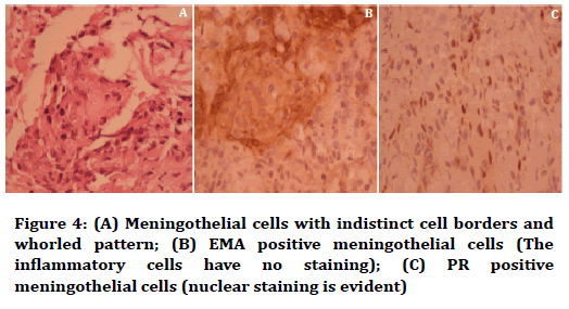 medical-dental-science-Meningothelial-cells