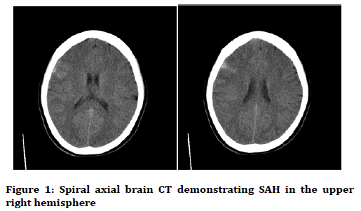 medical-dental-science-Spiral-axial-brain