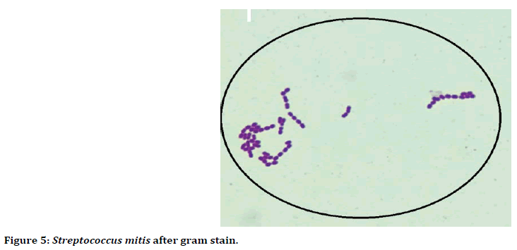 medical-dental-science-Streptococcus-mitis