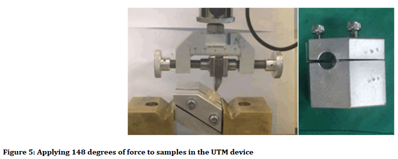 medical-dental-science-UTM-device