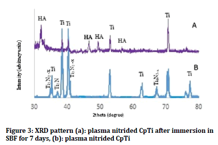 medical-dental-science-XRD-pattern