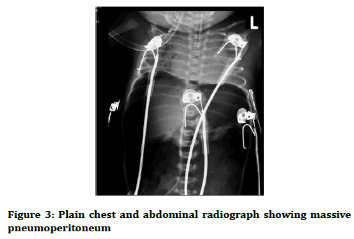 medical-dental-science-abdominal-radiograph