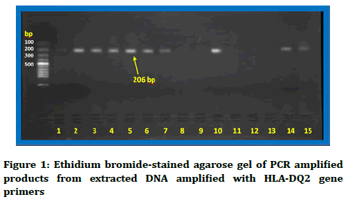 medical-dental-science-agarose-gel