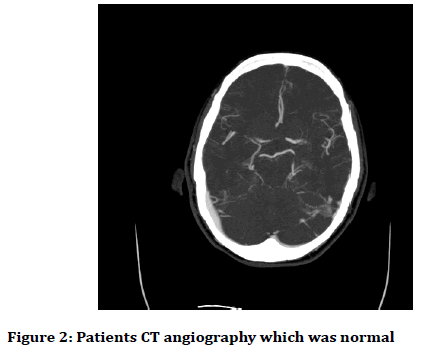 medical-dental-science-angiography