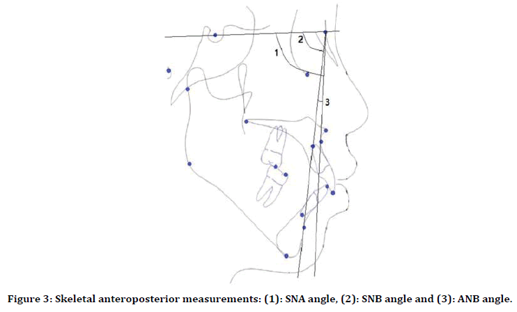 medical-dental-science-anteroposterior-measurements