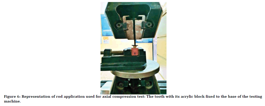 medical-dental-science-axial-compression