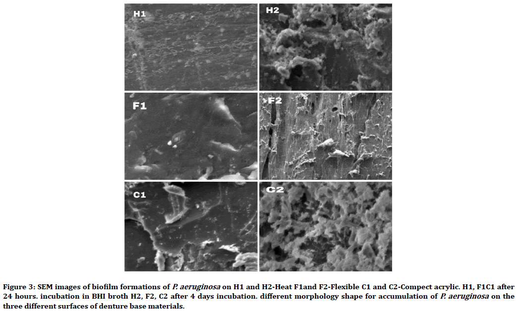 medical-dental-science-biofilm-formations