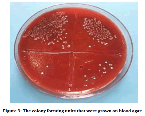 medical-dental-science-blood-agar