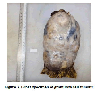 medical-dental-science-cell-tumour