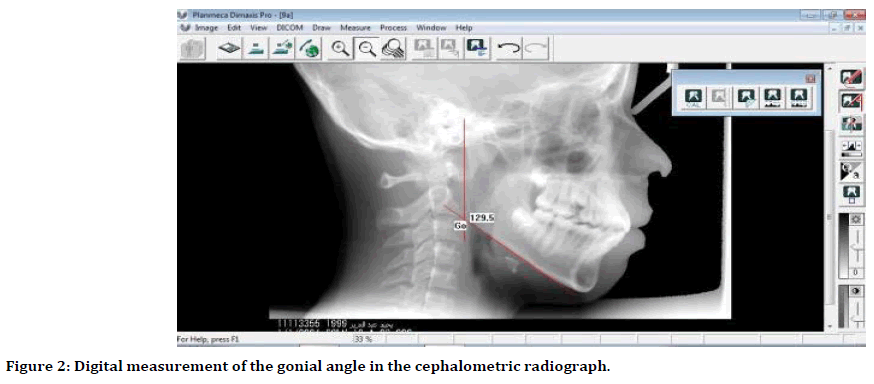 medical-dental-science-cephalometric-radiograph