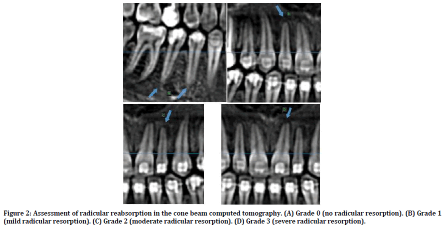 medical-dental-science-computed-tomography