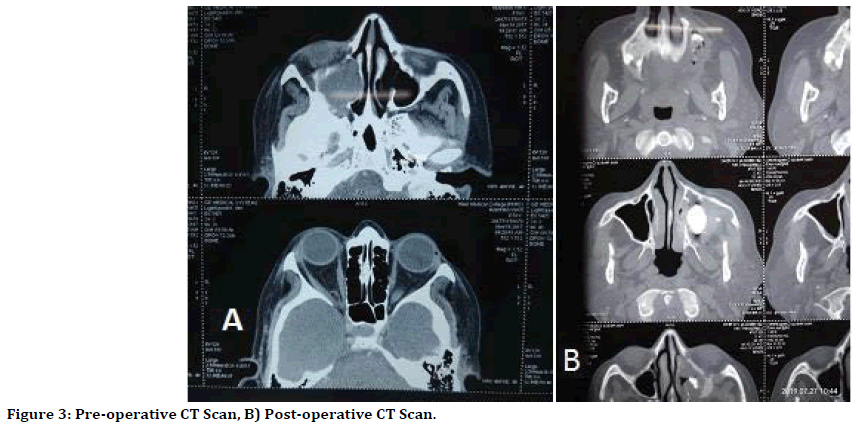 medical-dental-science-ct-scan