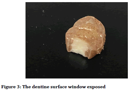 medical-dental-science-dentine-surface