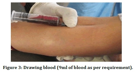 medical-dental-science-drawing-blood