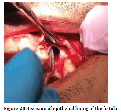 medical-dental-science-epithelial-lining