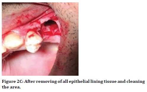 medical-dental-science-epithelial-lining-tissue