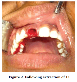 medical-dental-science-extraction