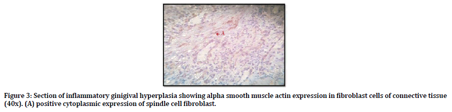medical-dental-science-fibroblast-cells