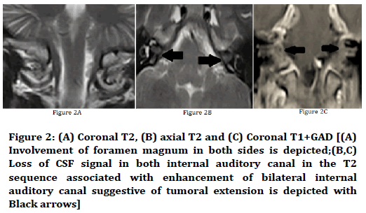 medical-dental-science-foramen-magnum