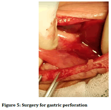 medical-dental-science-gastric-perforation