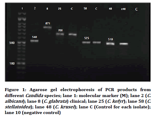 medical-dental-science-gel-electrophoresis