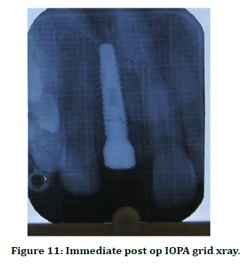 medical-dental-science-grid-xray