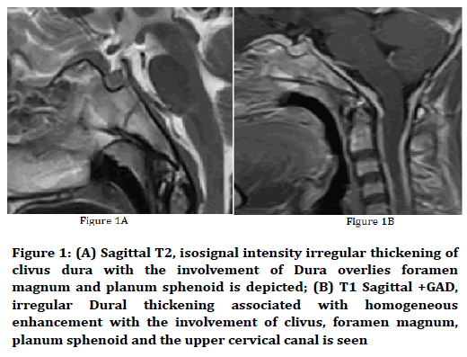 medical-dental-science-isosignal-intensity