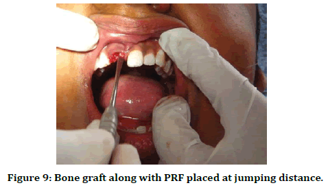 medical-dental-science-jumping-distance