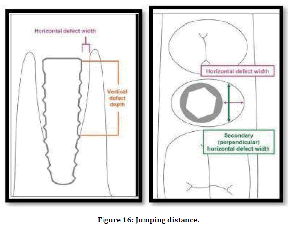 medical-dental-science-jumping-distance