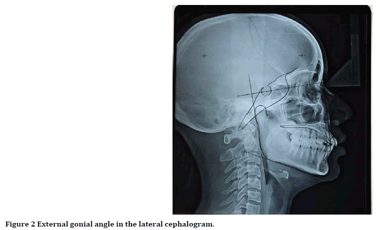 medical-dental-science-lateral-cephalogram