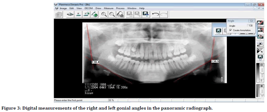 medical-dental-science-left-gonial-angles