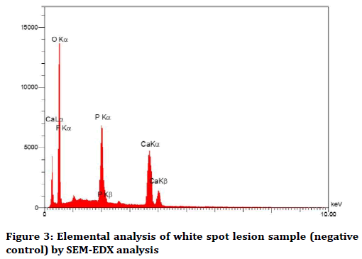 medical-dental-science-lesion-sample