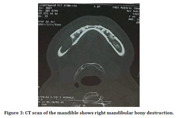 medical-dental-science-mandibular-bony