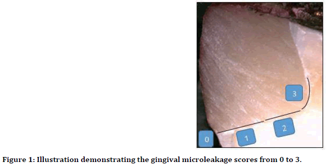 medical-dental-science-microleakage-scores