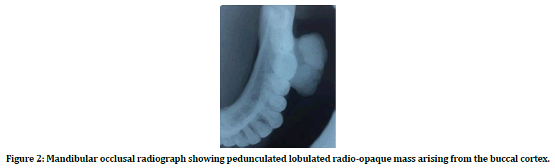 medical-dental-science-occlusal-radiograph