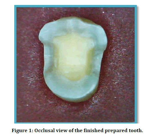 medical-dental-science-occlusal-view