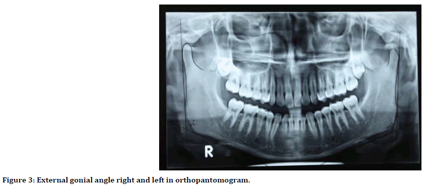 medical-dental-science-orthopantomogram