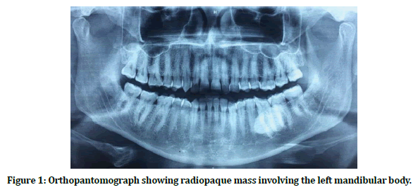 medical-dental-science-orthopantomograph