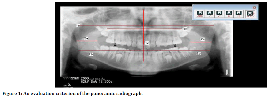 medical-dental-science-panoramic-radiograph