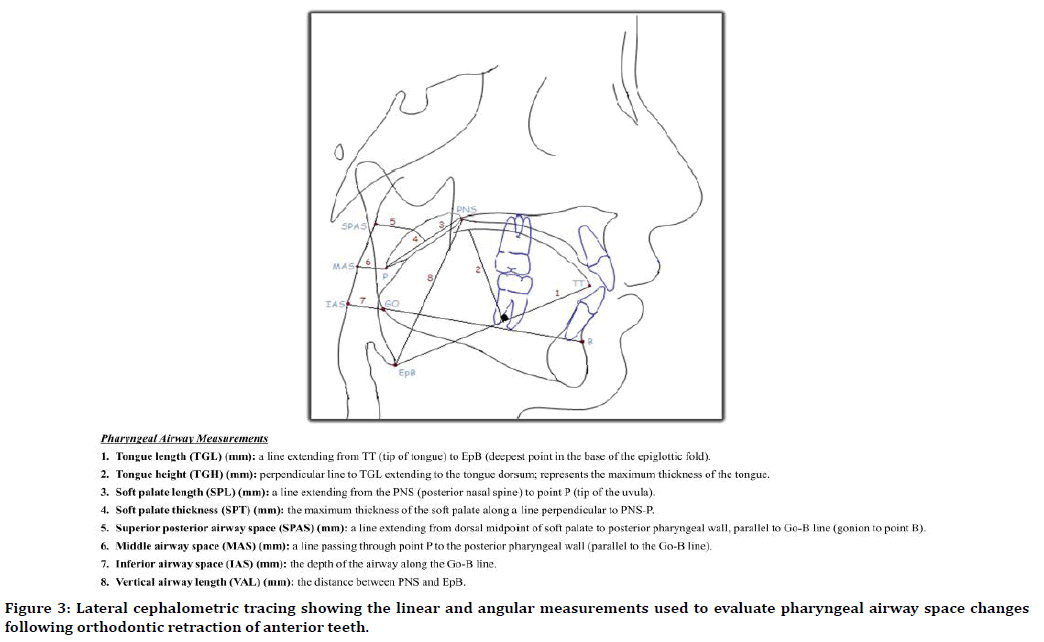 medical-dental-science-pharyngeal-airway