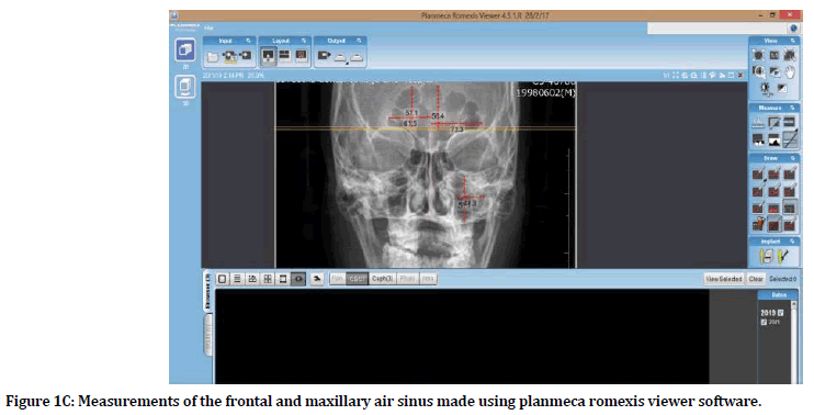 medical-dental-science-planmeca-romexis