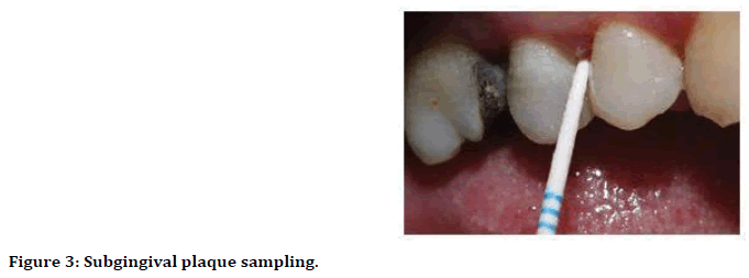 medical-dental-science-plaque-sampling