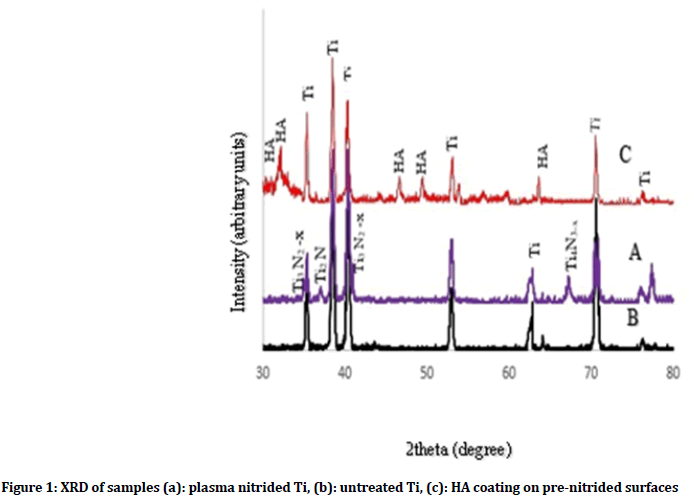 medical-dental-science-plasma-nitrided