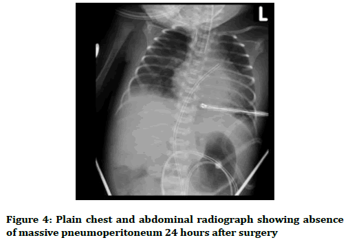 medical-dental-science-pneumoperitoneum