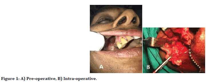 medical-dental-science-pre-operative