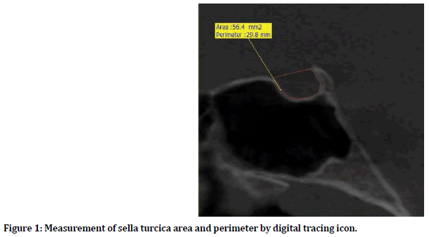 medical-dental-science-sella-turcica