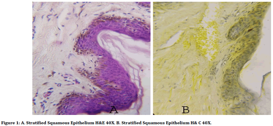 medical-dental-science-squamous-epithelium