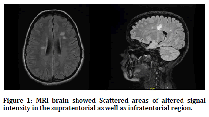 medical-dental-science-supratentorial