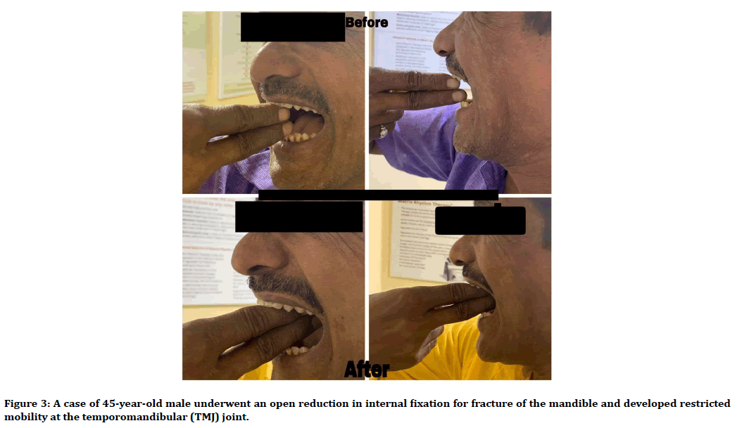 medical-dental-science-temporomandibular