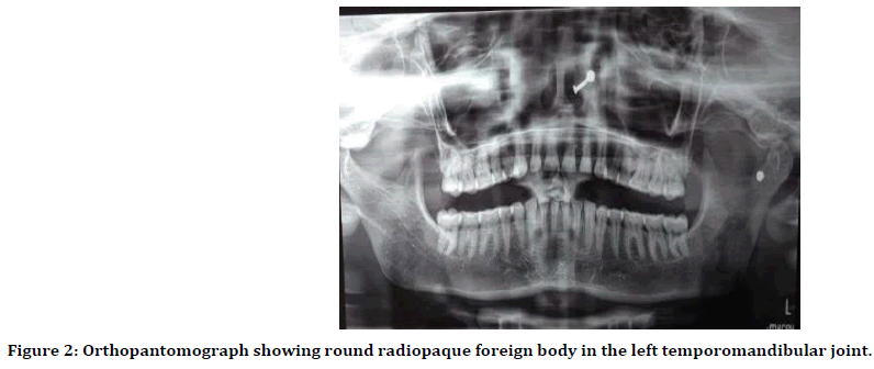 medical-dental-science-temporomandibular-joint